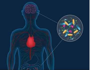 Boala Parkinson își poate avea originea în intestine, nu în creier (studiu)